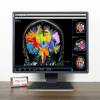 Màn hình 21 inch Eizo RadiForce GX550